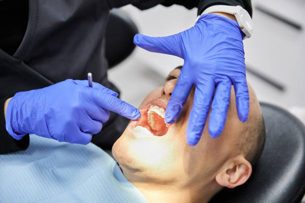 Best Broken or Chipped Tooth Repair in Mahopac, NY